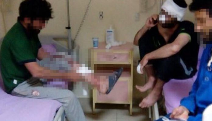 Nationalist mob attacks Kurdish workers in Ankara